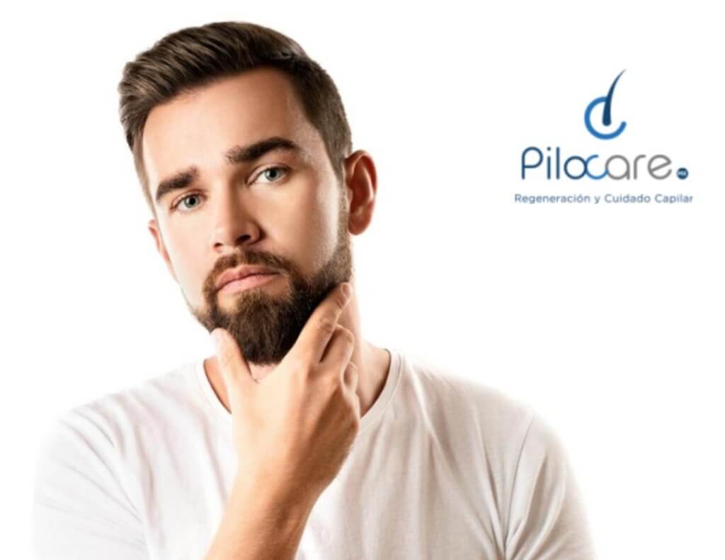 Hombre con injerto de barba
